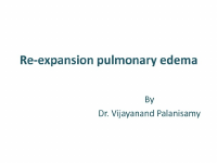 Re-expansion pulmonary edema.pptx